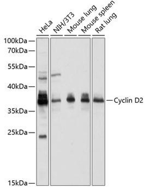 Cell Cycle Antibodies 1 Anti-Cyclin D2 Antibody CAB1773