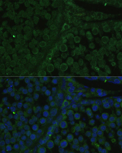 Epigenetics and Nuclear Signaling Antibodies 3 Anti-IGF2BP2 Antibody CAB1774