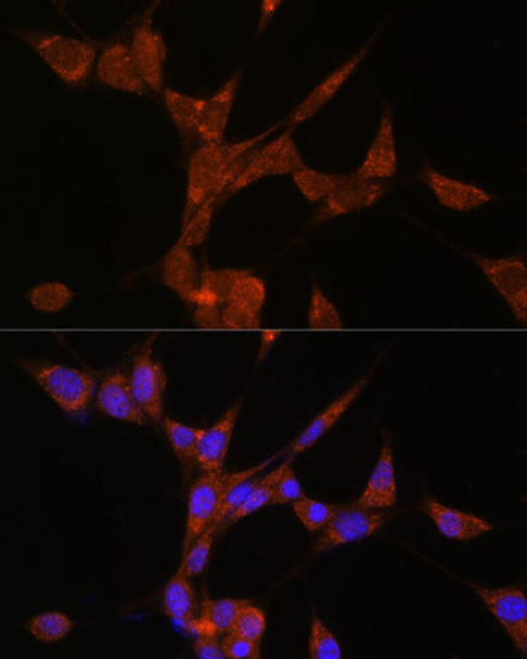 Cell Biology Antibodies 7 Anti-AKR1C3 Antibody CAB1781