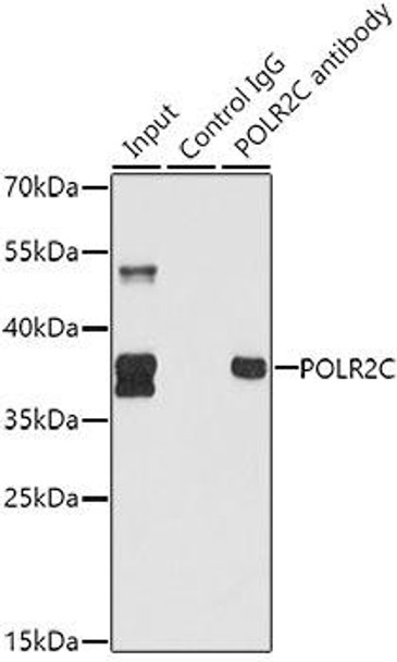 Epigenetics and Nuclear Signaling Antibodies 3 Anti-POLR2C Antibody CAB1785