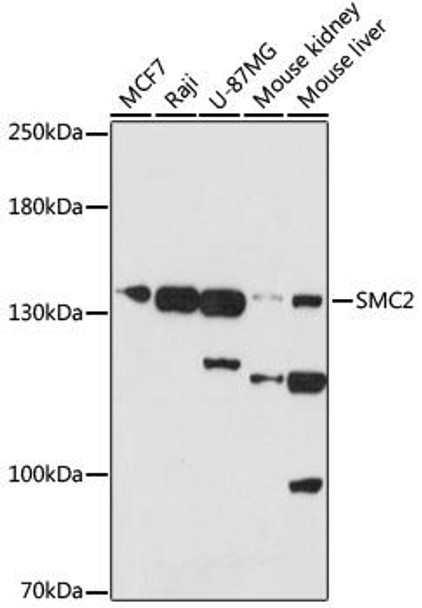 Cell Cycle Antibodies 1 Anti-SMC2 Antibody CAB17867