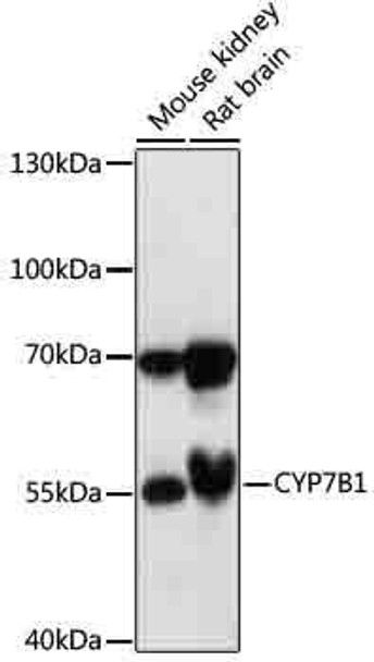 Metabolism Antibodies 2 Anti-CYP7B1 Antibody CAB17872