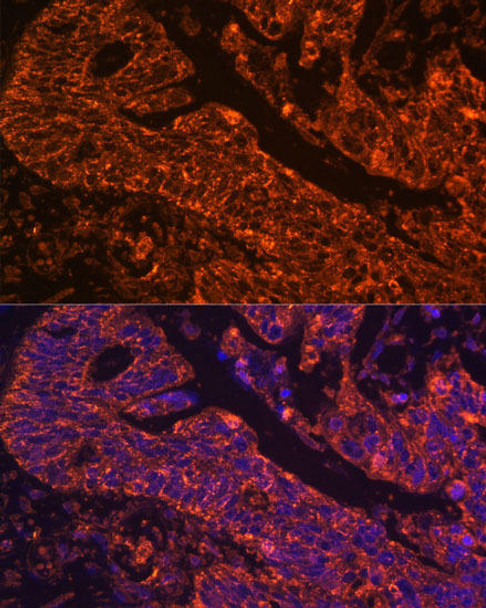 Developmental Biology Anti-AXL Antibody CAB17874