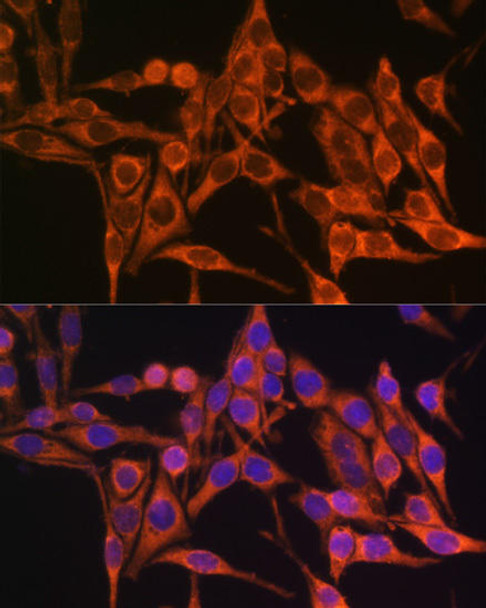 Metabolism Antibodies 2 Anti-MT-ATP8 Antibody CAB17890