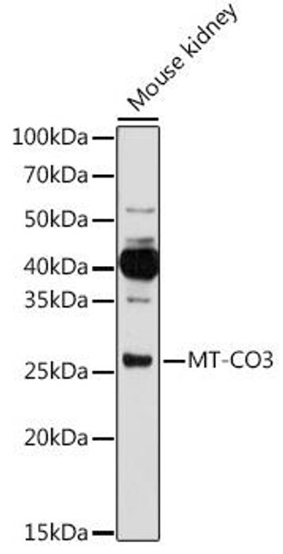 Cell Biology Antibodies 7 Anti-MT-CO3 Antibody CAB17891