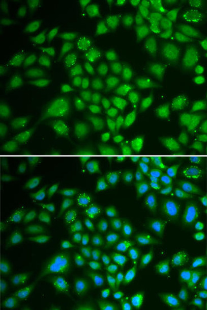 Cell Biology Antibodies 7 Anti-DCK Antibody CAB1794