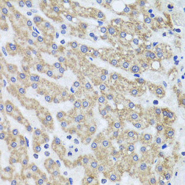 Cell Biology Antibodies 7 Anti-ACP1 Antibody CAB1801
