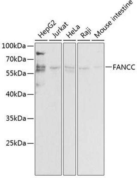 Epigenetics and Nuclear Signaling Antibodies 3 Anti-FANCC Antibody CAB1812