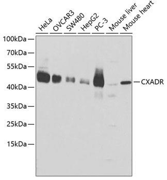 Cell Biology Antibodies 7 Anti-CXADR Antibody CAB1822