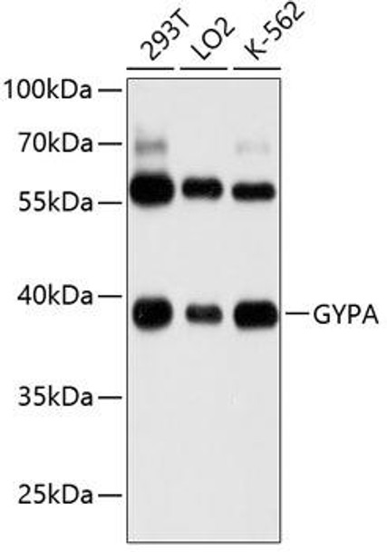 Immunology Antibodies 2 Anti-GYPA Antibody CAB1827