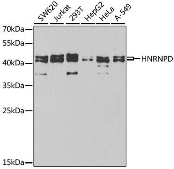 Cell Biology Antibodies 7 Anti-HNRNPD Antibody CAB1828