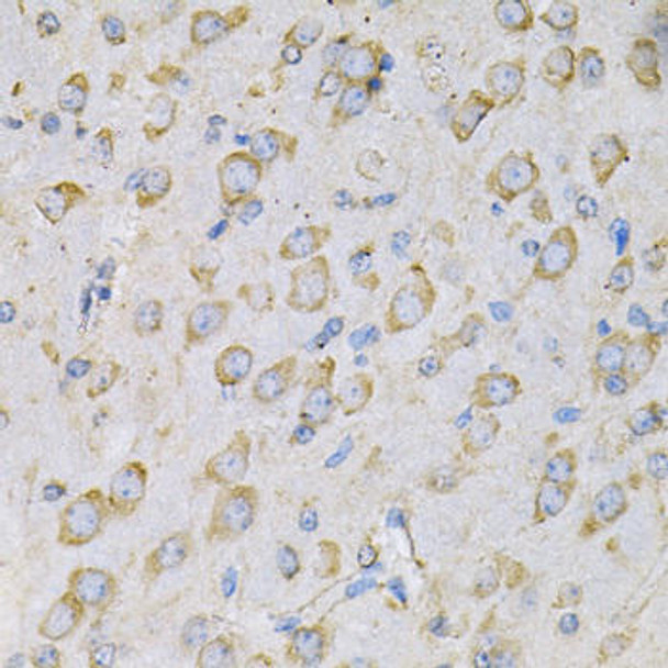 Cell Biology Antibodies 7 Anti-IL-10RA Antibody CAB1830