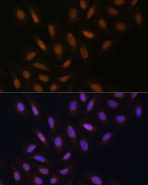 Epigenetics and Nuclear Signaling Antibodies 3 Anti-DNA polymerase eta Antibody CAB1833