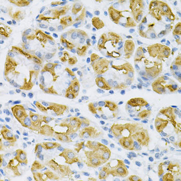 Cell Biology Antibodies 7 Anti-SDC4 Antibody CAB1834