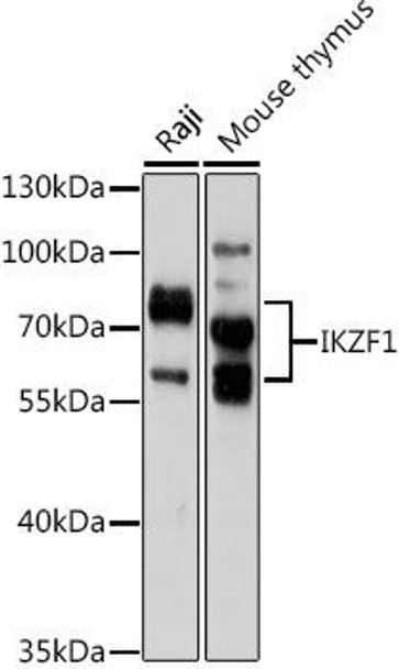 Cell Cycle Antibodies 1 Anti-IKZF1 Antibody CAB1850