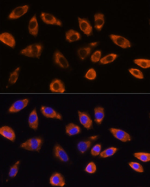 Cell Biology Antibodies 7 Anti-GNB1 Antibody CAB1867