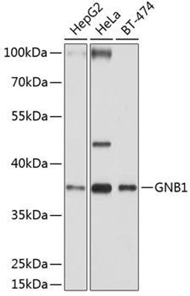 Cell Biology Antibodies 7 Anti-GNB1 Antibody CAB1867