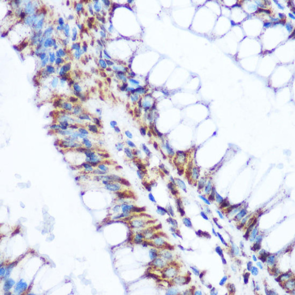 Metabolism Antibodies 2 Anti-PDHA1 Antibody CAB1895