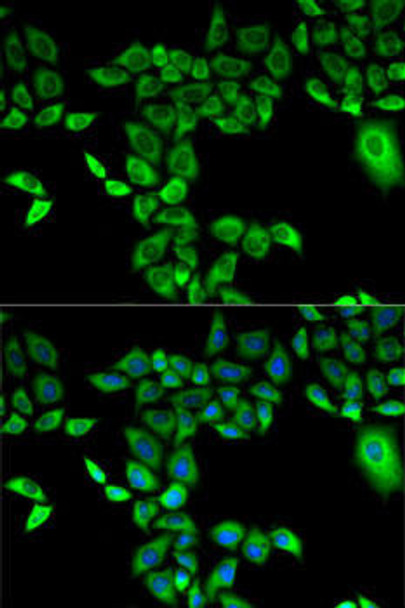 Cell Biology Antibodies 7 Anti-FMO3 Antibody CAB1901