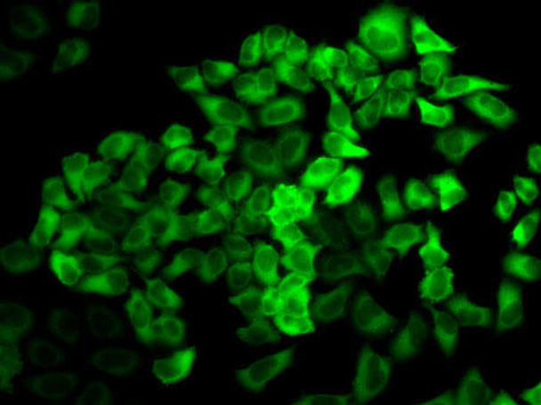 KO Validated Antibodies 1 Anti-PRDX2 Antibody CAB1919KO Validated