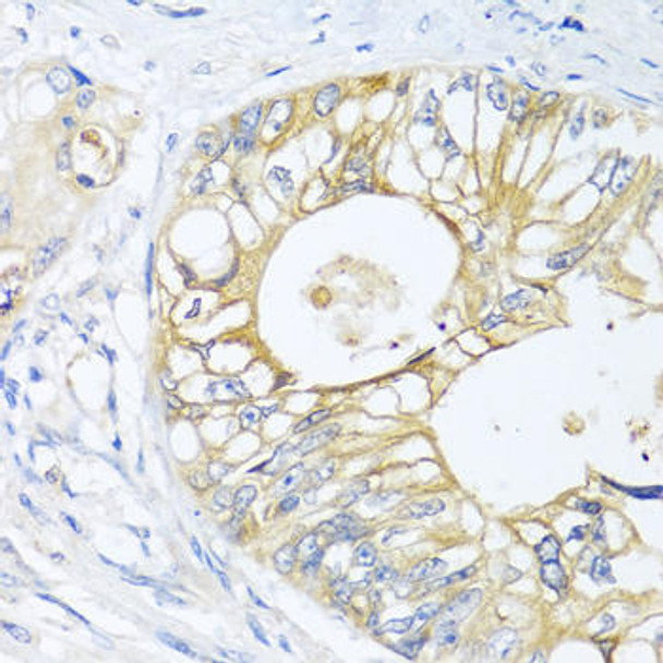 Cell Cycle Antibodies 1 Anti-GNAI3 Antibody CAB1922