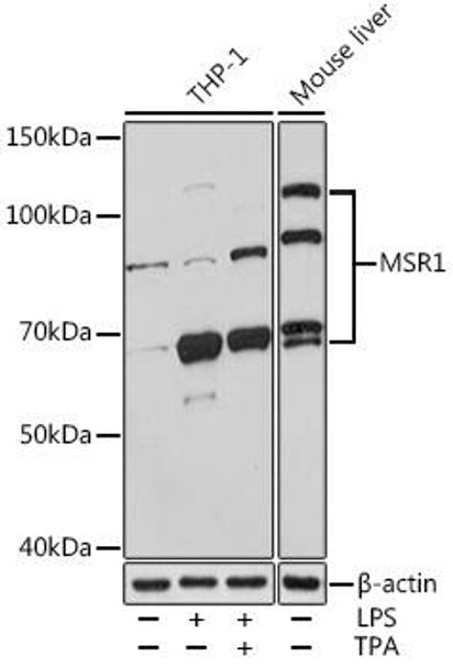 Cell Biology Antibodies 7 Anti-MSR1 Antibody CAB1923