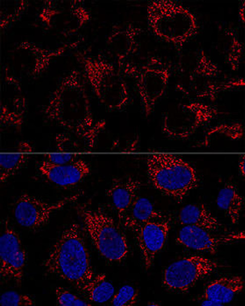 Epigenetics and Nuclear Signaling Antibodies 3 Anti-TFAM Antibody CAB1926