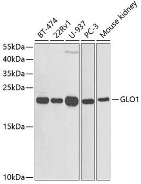Cell Biology Antibodies 7 Anti-GLO1 Antibody CAB1932
