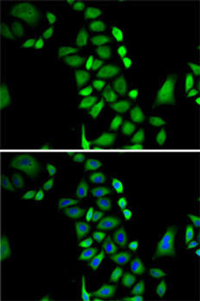 Cell Biology Antibodies 7 Anti-GLO1 Antibody CAB1932