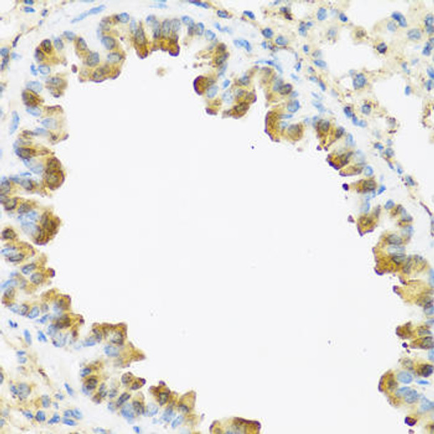 Cell Biology Antibodies 7 Anti-S100A7 Antibody CAB1940