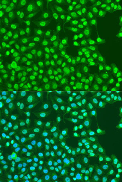 Epigenetics and Nuclear Signaling Antibodies 3 Anti-EXO1 Antibody CAB1941