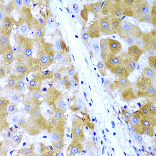 Immunology Antibodies 2 Anti-TIRAP Antibody CAB1943
