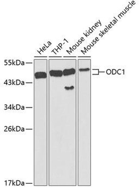 Metabolism Antibodies 2 Anti-ODC1 Antibody CAB1948
