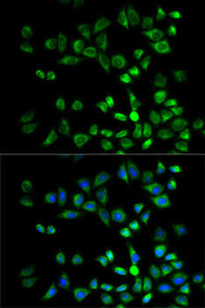 Cell Death Antibodies 1 Anti-PSMD10 Antibody CAB1949