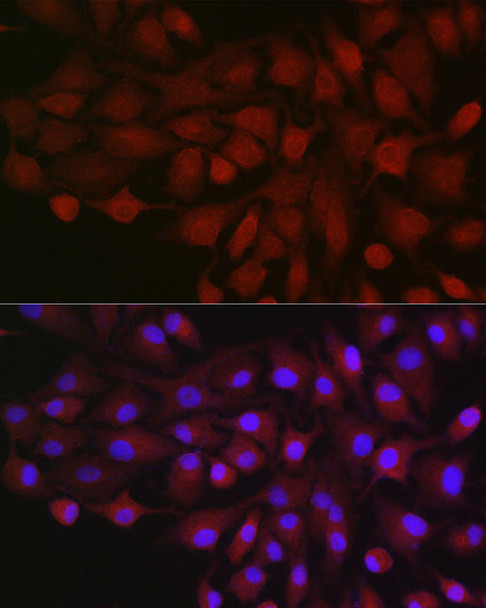 Cell Biology Antibodies 8 Anti-BDKRB1 Antibody CAB1959