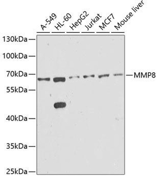 Cell Biology Antibodies 8 Anti-MMP8 Antibody CAB1963