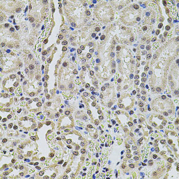 Neuroscience Anti-SMARCC2 Antibody CAB1967