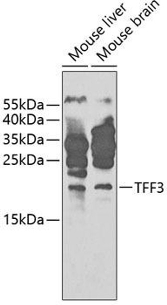 Cell Biology Antibodies 8 Anti-TFF3 Antibody CAB1978
