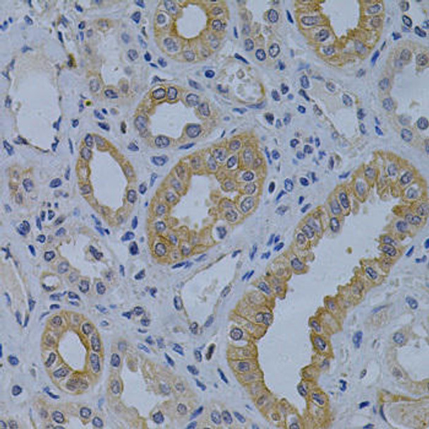 Epigenetics and Nuclear Signaling Antibodies 3 Anti-MVP Antibody CAB1980