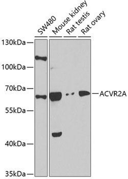 Cell Biology Antibodies 8 Anti-ACVR2A Antibody CAB1981