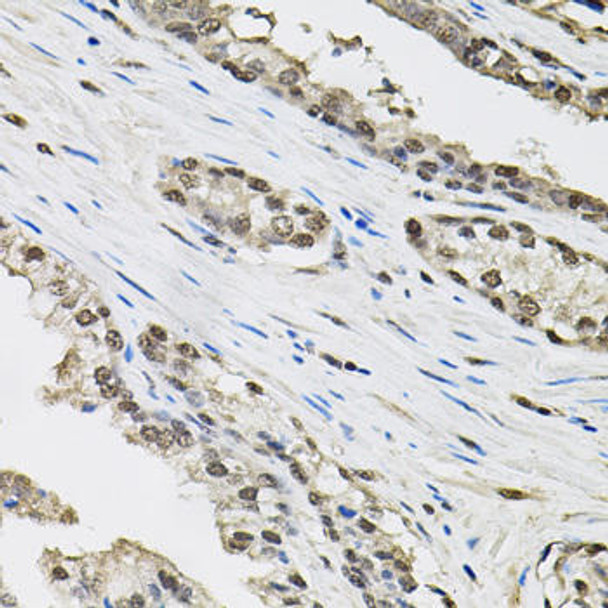 Immunology Antibodies 2 Anti-TCEB1 Antibody CAB1989