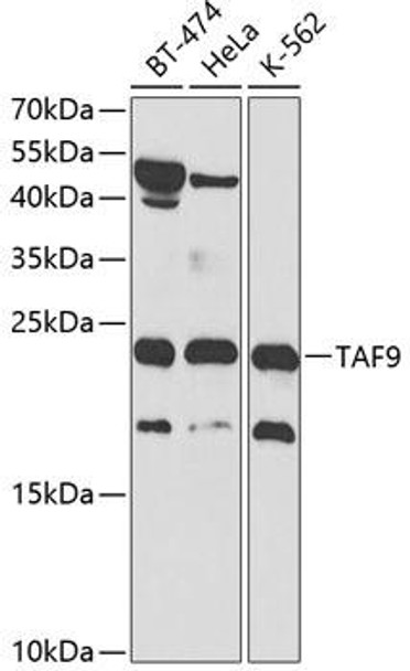 Epigenetics and Nuclear Signaling Antibodies 3 Anti-TAF9 Antibody CAB2021