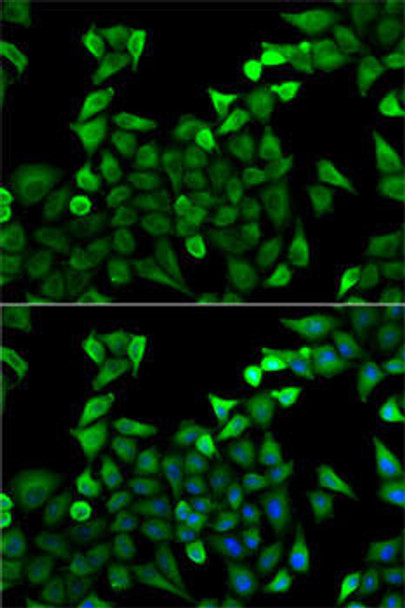 Cell Biology Antibodies 8 Anti-TPSAB1 Antibody CAB2022