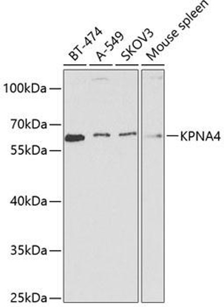 Immunology Antibodies 2 Anti-KPNA4 Antibody CAB2026