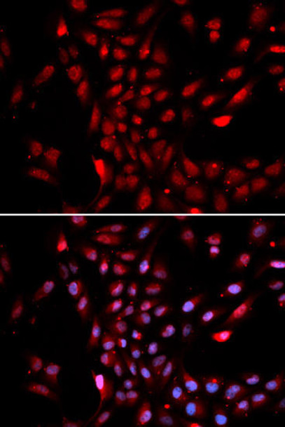 Immunology Antibodies 2 Anti-KPNA4 Antibody CAB2026