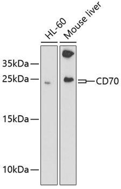 Cell Biology Antibodies 8 Anti-CD70 Antibody CAB2032