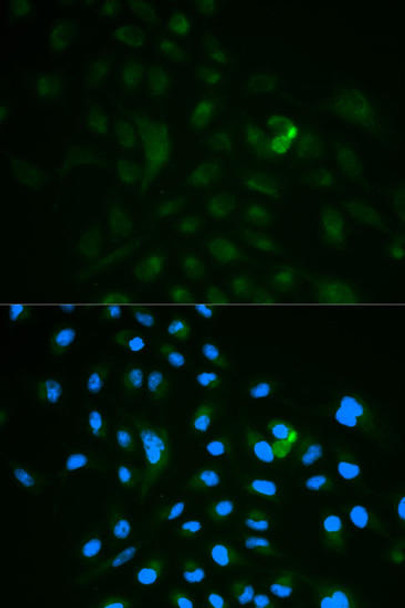 Immunology Antibodies 2 Anti-CD79B Antibody CAB2033