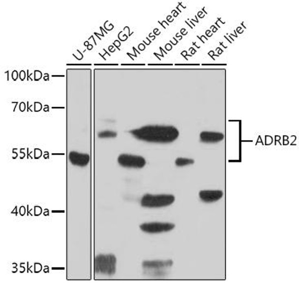 Cell Biology Antibodies 8 Anti-ADRB2 Antibody CAB2048