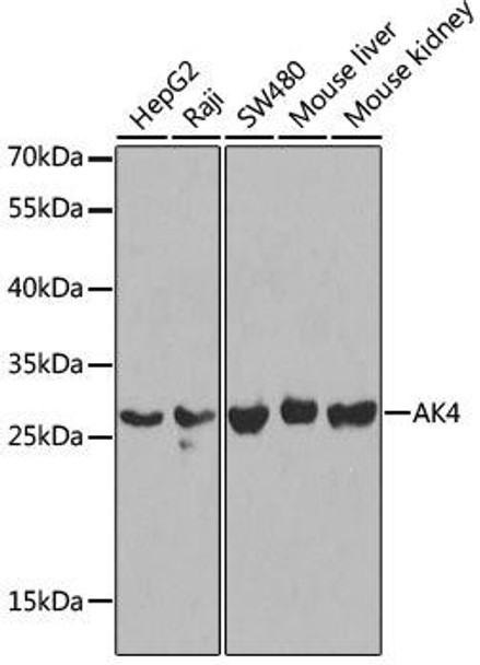 Cell Biology Antibodies 8 Anti-AK4 Antibody CAB2050