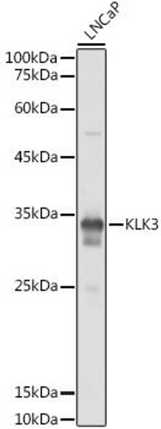 Cell Biology Antibodies 8 Anti-KLK3 Antibody CAB2052